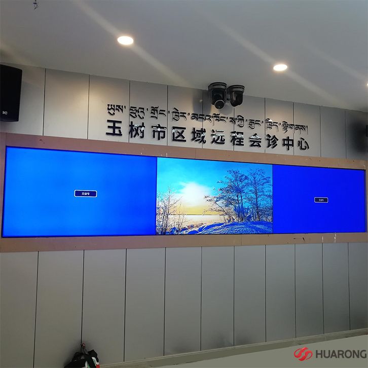 青海65寸3.5mm拼缝极悦注册会诊中心