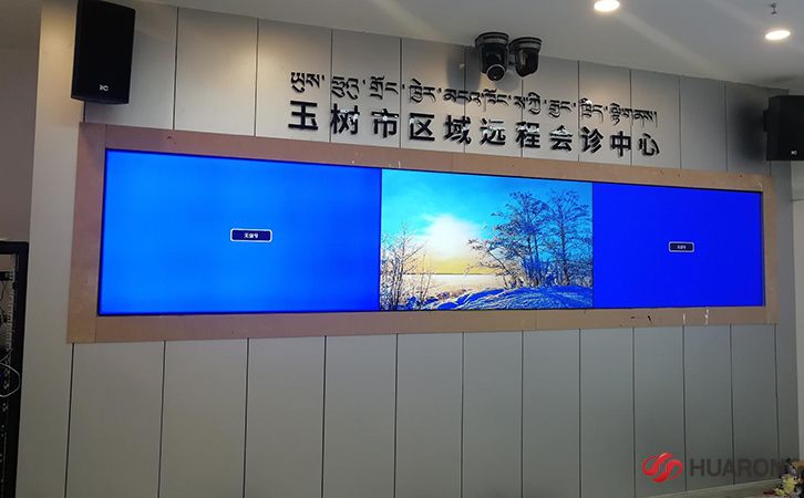 65寸极悦注册正面